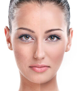 Affordable Plastic Surgery in Coimbatore