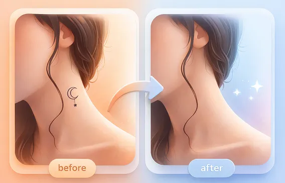 tattoo-removal-laser-treatment-near-you tattoo-removal-laser-treatment-near-you